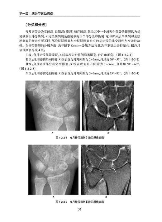 腕和手运动损伤影像诊断 白荣杰 殷玉明 袁慧书编 腕和手相关的新鲜标本的断层解剖与MR影像对照人民卫生出版社9787117327718 商品图4