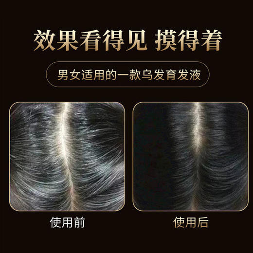 【白发转黑发】南京同仁堂蔓浓乌发育发液浓密发头发长发剂发际线何首乌白转黑 商品图4