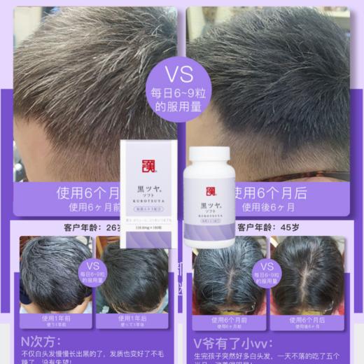 日本WAKAN和汉方黑发灵丸胶囊少白头发变转黑乌发脱丸神器 商品图5