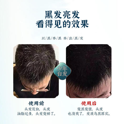 【买2立减19】百年品牌黑灵芝当归植萃洗发水滋润营养乌发黑发白发转黑洗发露 商品图2