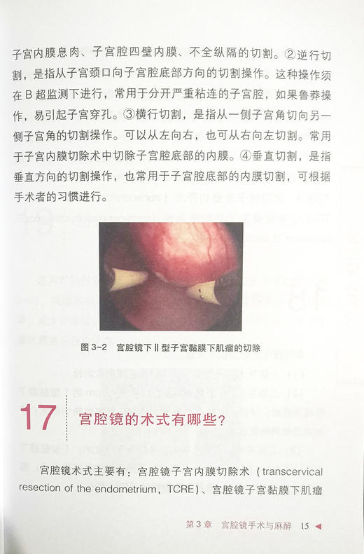 宫腔镜100问 中华医学健康科普工程 黄胡信 冯力民 王素敏 宫腔镜诊治科普宫腔镜手术并发症 中华医学电子音像出版社9787830052867 商品图4