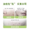 新品 绽妍祛痘凝胶30g(二械） 商品缩略图3