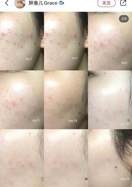 无限回购！修丽可色修精华15ml/30ml 商品图6