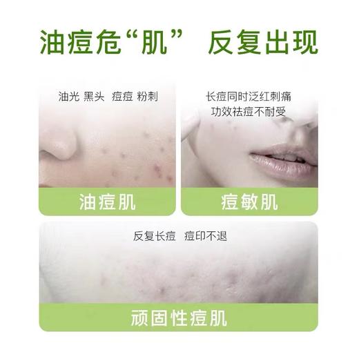 新品 绽妍祛痘面膜5片/盒（二械） 商品图3