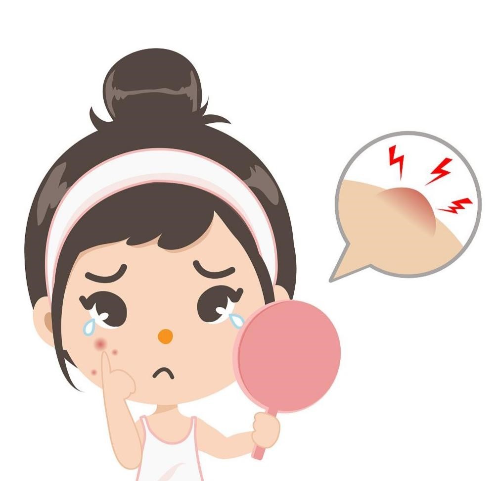 11 | 4种不同类型，一分钟教你分型而祛，精准祛痘！