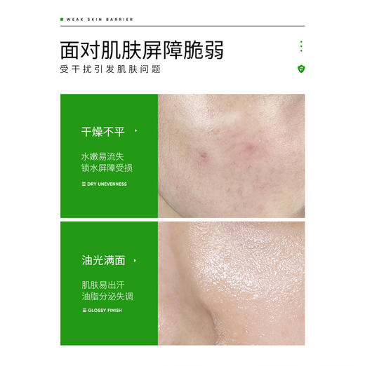 【买1送1】 库拉索芦荟凝胶精粹清爽控油 补水保湿 舒缓止痒40g 商品图1