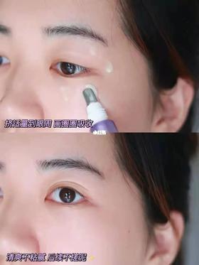 🧏即刻拥有超A眼，抚褪眼纹‼️