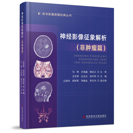 神经影像征象解析非肿瘤篇 医学影像联盟丛书 王宇军 白玉贞 徐守军 神经系统疾病影像诊断 科学技术文献出版社9787518985081 商品图1