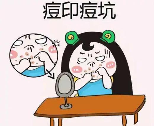 13 | 红痘印“杀手”，黑痘印“克星” 商品图0
