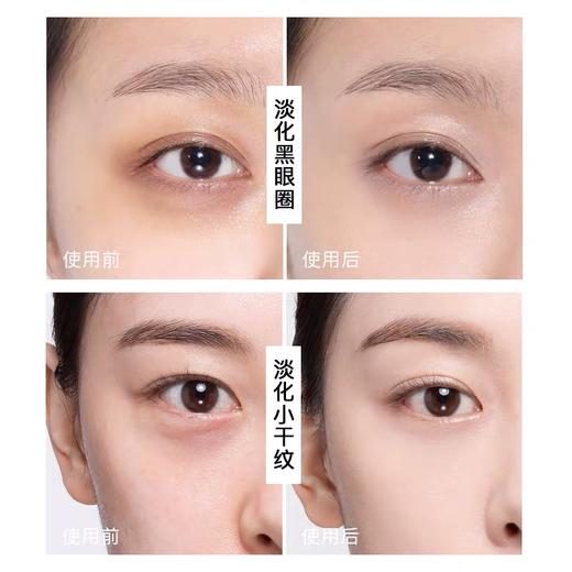 【中欧班列精选】日本黛珂小紫瓶赋活精华眼霜淡化黑眼圈细纹补水保湿15g LPY 商品图3