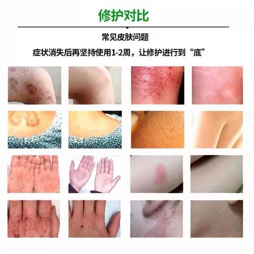 【百草止痒膏】百草止痒 瘙痒湿痒软膏 外用苗方草本乳膏30g 商品图3