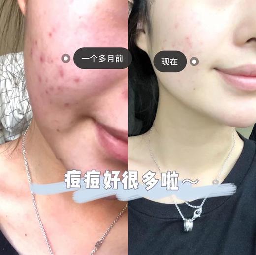 朵拉朵尚茶树净颜嫩肤皂2块 22DD419 商品图5