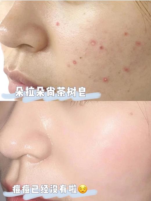 朵拉朵尚茶树净颜嫩肤皂2块 22DD419 商品图6