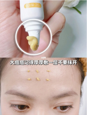 国货祛痘膏太绝！祛痘不走弯路！