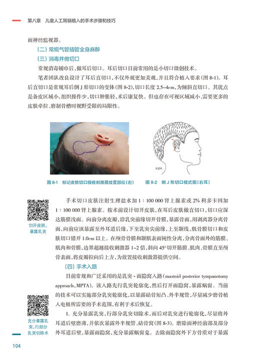 儿童人工耳蜗植入 李琦 戴朴 主编 儿科学植入者适应证手术步骤小龄儿童植入 术后听觉言语康复 人民卫生出版社9787117326766 商品图4