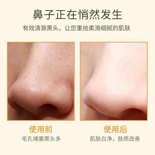 【梦诗肌黑头清理液】软化角质清除黑头粉刺平衡油脂深层起清洁黑头清洁液 商品图3