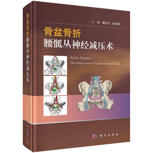 骨盆骨折腰骶丛神经减压术 樊仕才 侯志勇 主编 各神经根的支配功能骨盆骨折特点 神经减压手术临床 科学出版社9787030713278 商品图1