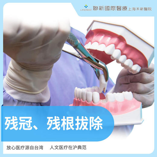 残冠、残根简单拔除 商品图0