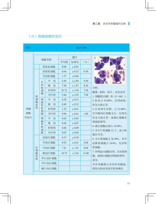 正版 多发性骨髓瘤居家治疗手册 吴德沛 傅琤琤 主编 多发性骨髓瘤 不良反应分级与处理 中国协和医科大学出版社9787567918818 商品图4