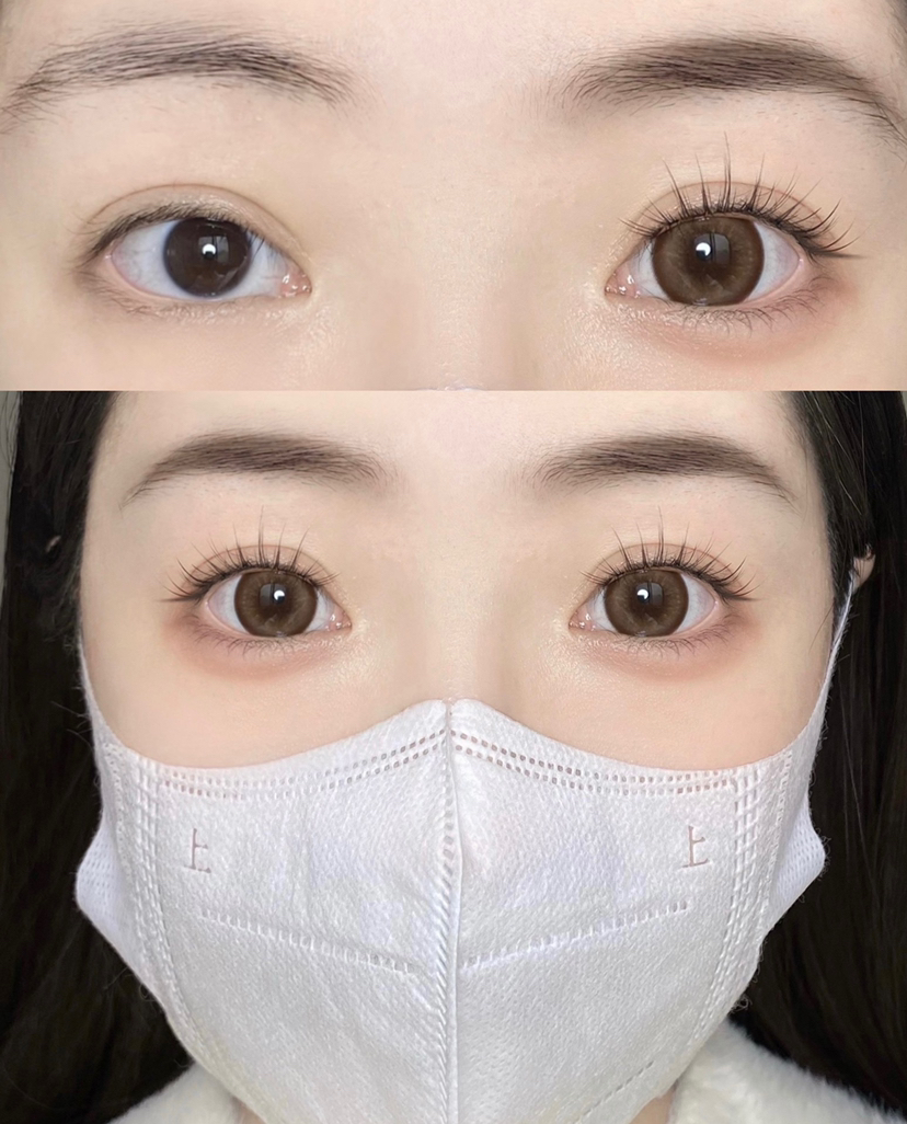 大直径推荐丨冰点朗姆·Doriscon丨14.5mm（年抛/2片装）