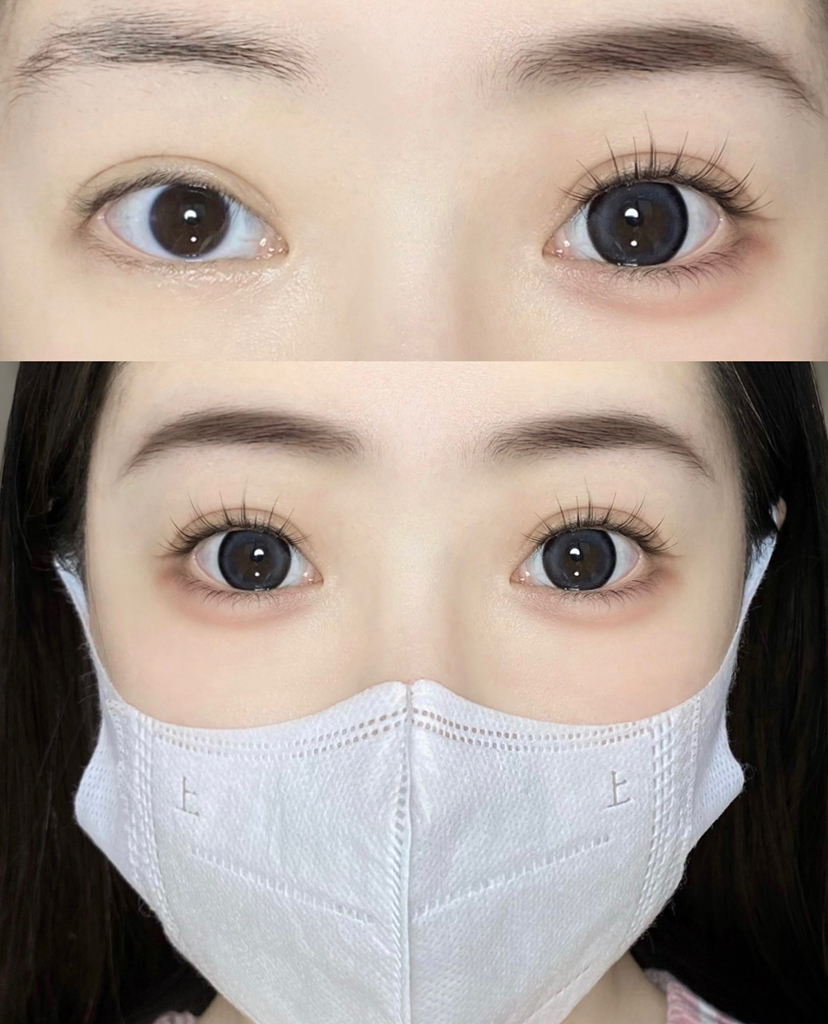 大直径推荐丨黑桃香槟·Doriscon丨14.5mm（年抛/2片装）