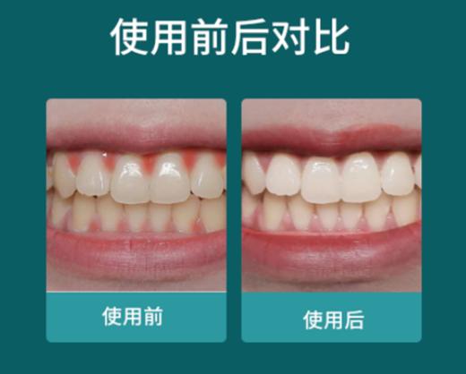 【总部自研】九典秘制牙粉 纯中药配制 高难度工艺制作 商品图10