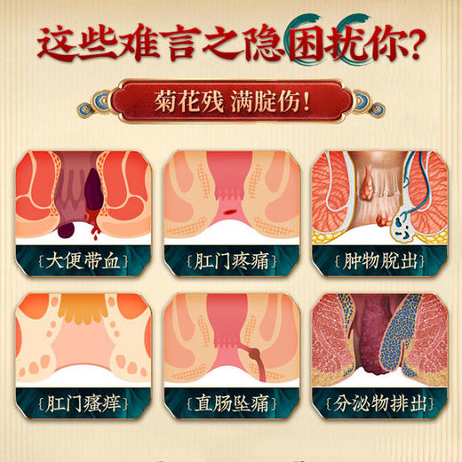 【买2送1】痔疮清道夫痔在必除南京同仁堂痔疮膏 商品图1