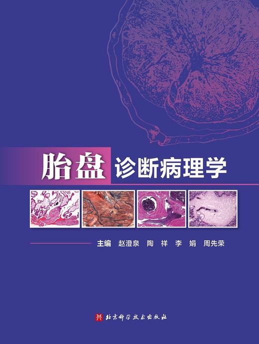 胎盘诊断病理学 讲解胎盘病理的诊断、规范诊断用语及各类病变的临床意义 赵澄泉 等主编 9787571420536北京科学技术出版社 商品图2