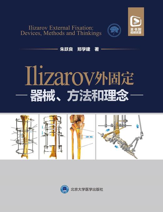 Ilizarov外固定 器械 方法和理念 基本原理基本部件胫骨横向搬移和相关技术 朱跃良 郑学建 9787565924873北京大学医学出版社 商品图2