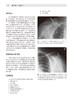 临床急诊影像学 第2版 周福庆 曾献军 译 影像征象基础影像检查的诊断性成像陷阱和成像局限性 人民卫生出版社9787117327510 商品缩略图4