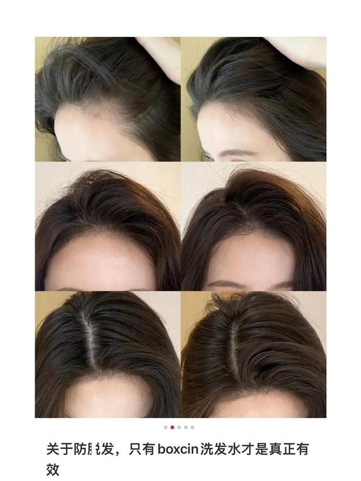 秃头宝贝集合！土耳其bioxcin洗发水防脱柏科生控油蓬松固发控油 商品图5