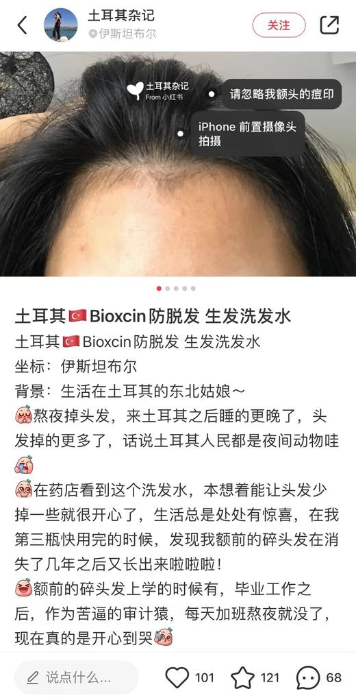 秃头宝贝集合！土耳其bioxcin洗发水防脱柏科生控油蓬松固发控油 商品图11