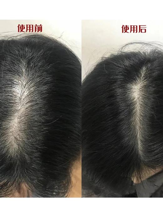 秃头宝贝集合！土耳其bioxcin洗发水防脱柏科生控油蓬松固发控油 商品图3