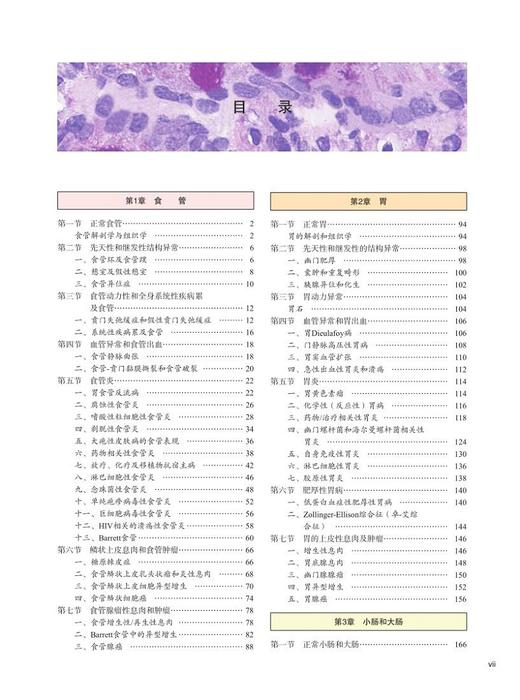 消化内镜与病理对照诊断学 中文翻译版 胃肠疾病的临床大体特征内镜表现 组织学特征 张澎田 李巍 译9787030630483科学出版社 商品图4