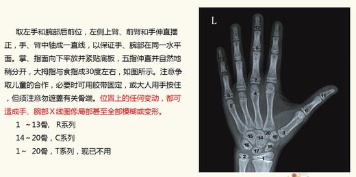 ⁷【身高管理】深圳身高门诊 -骨龄片解读 ZX07-CRMM-WLMZ 商品图8