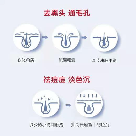 【优惠装~买二送一！超值装~买三发五！！】芙诗婷15％壬二酸凝露凝胶祛痘膏去粉刺温和提亮肌肤壬二酸软膏洁面 商品图3