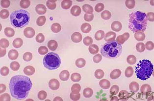 白细胞正常值范围是多少 