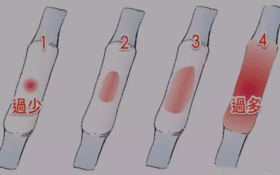 艾灸调理闭经、月经量少“一灸见血”！ 
