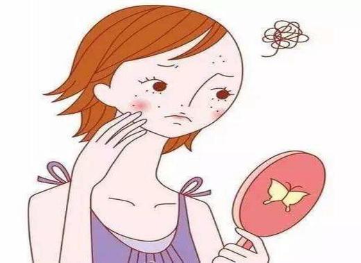 24 | “黄脸婆”“斑花”仙子级护理攻略 商品图0