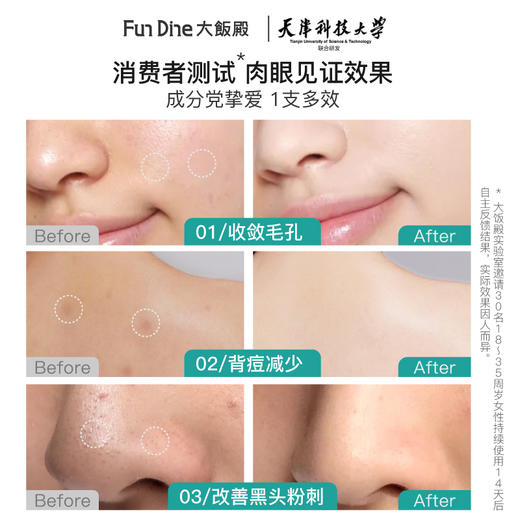 【已下架】油皮本命痘肌“大补药” | 大饭殿 药用层孔菌绿酵母祛痘膏20g*2支[福利品] 商品图4