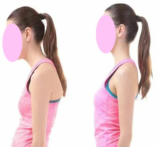 妙姿妈妈哺乳体态管理4选1（仅限新客） 商品图2