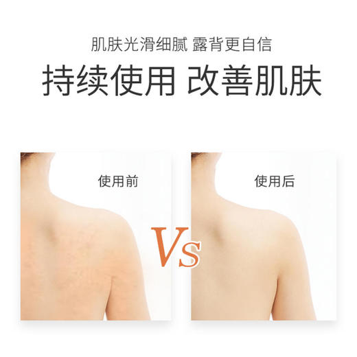 【第2瓶半价】珂蓓丝桉树油清螨沐浴露深层清螨洁净肌肤控制肌肤水油平衡持久留香男女通用 商品图3