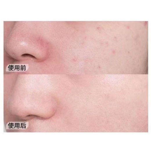 【第二件半价】瑞士进口魅力家焕颜精华液30ml 商品图4