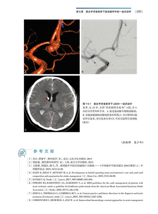 神经外科复合手术学 赵继宗 对神经外科一站式复合手术进行系统介绍 治疗脑血管病肿瘤脊髓疾病 人民卫生出版社9787117325011 商品图4