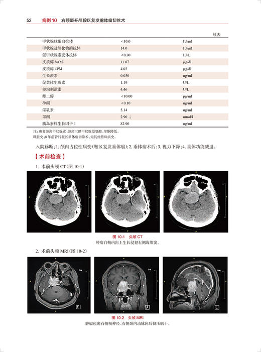 正版 神经外科围手术期出血防治专家共识病例荟萃 王硕 手术视频关键操作步骤 术后病人影像学资料 人民卫生出版社9787117328470 商品图4