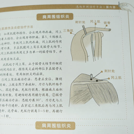【正版】图解针灸大全 针灸针刀手法学针灸治疗书书 人体经络针灸穴位图解各种手法 中医养生入门基础理论针灸的书针灸书籍 商品图4