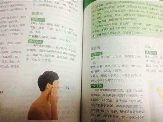 【正版】 精版臧俊岐图说针灸点穴按摩拔罐 中医养生入门 实用按摩大全艾灸保健 经络穴位 针灸取穴位图解大全 对症疗法畅销书籍 商品图4