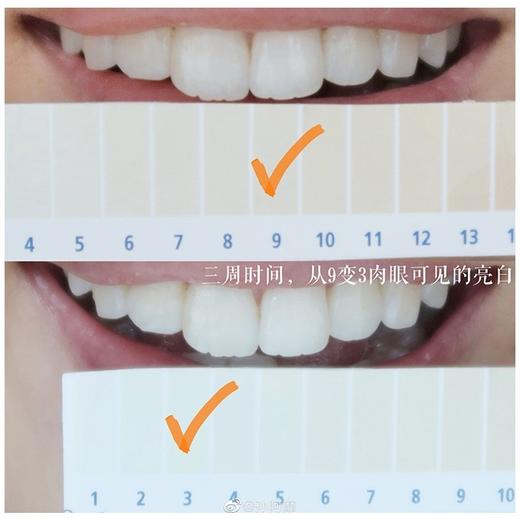 跳水价必囤！！！贝嫂同款！pearldrops倍洁丽去牙渍美白牙膏100g 商品图4