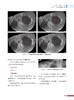 正版现货 儿童骨科创伤病例图谱 国际骨科学译著 孙军 主译 Springer出品 儿科骨科手术病例图谱 中国科学技术出版社9787504686534 商品缩略图4