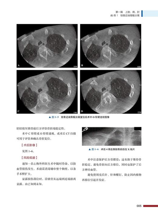 正版现货 儿童骨科创伤病例图谱 国际骨科学译著 孙军 主译 Springer出品 儿科骨科手术病例图谱 中国科学技术出版社9787504686534 商品图4